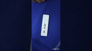 Malaria test in emergency ward emergency duty hospital nursing doctor subscribe mbbs [upl. by Enutrof]