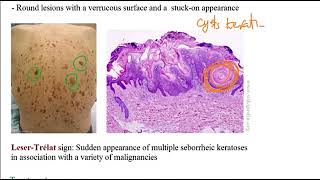 USMLE ACE Video 192 Skin Disorders Overview [upl. by Akkina]