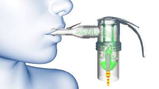 PARI LC® Nebulizer Animation [upl. by Cresa]