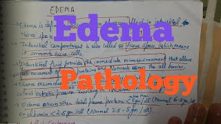 Edema Pathology [upl. by Marie-Ann]