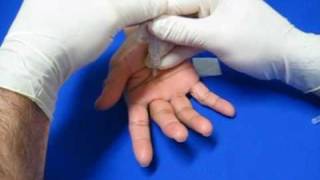 Hand Injection Techniques  Trigger Finger [upl. by Eltsirk]