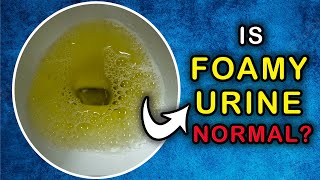 Is it NORMAL to have a FOAMY URINE Cause and Treatment [upl. by Aenneea]