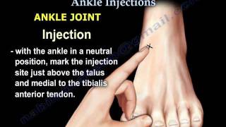 Common Foot And Ankle Injections  Everything You Need To Know  Dr Nabil Ebraheim [upl. by Aggarwal]