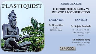 JOURNAL CLUB Electric burns Early Vs Late Recon [upl. by Pournaras472]