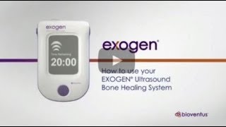 How to use EXOGEN cae [upl. by Ahsieni]