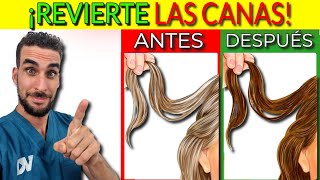 ¡REVELADO REDUCIR las CANAS NATURALMENTE con REMEDIOS CASEROS [upl. by Lorolla]