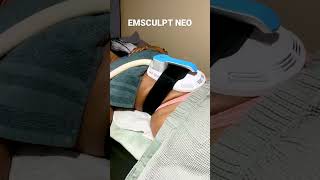 Emsculpt NEO for Abs [upl. by Ahsilet]