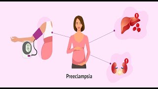 Warning signs of preeclampsia [upl. by Hayman]