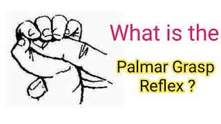 What is Palmar Grasp Reflex  Primitive reflex  Newborn reflex [upl. by Row]