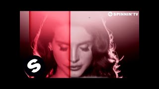 Lana Del Rey vs Cedric Gervais Summertime Sadness Remix [upl. by Boony668]