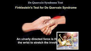 De Quervain Syndrome Test  Everything You Need To Know  Dr Nabil Ebraheim [upl. by Abisha747]