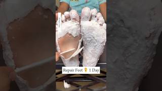 Repair Cracked Heels In 1Day  Get Rid Of Dry Feet  Get Fair amp Soft Feet Instantly cracked shorts [upl. by Zabrina]