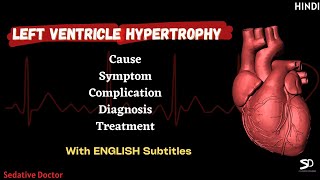 LVH  Left Ventricular Hypertrophy  Cause Symptoms Treatment  Hindi  Sedative Doctor [upl. by Ennaeilsel222]