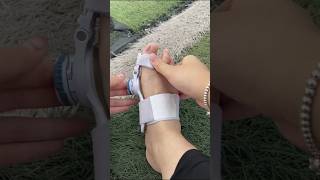 Part 146 bigfootboneprotrusion thumbvalgus separate toesviralvideoytshorts [upl. by Linell]