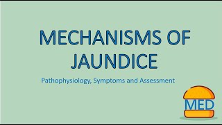 JAUNDICE MADE EASY  Mechanism Pathophysiology and Assessment [upl. by Obla914]