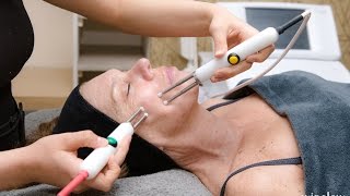 New CACI Non Surgical Face Lift for Instant Results [upl. by Campy573]