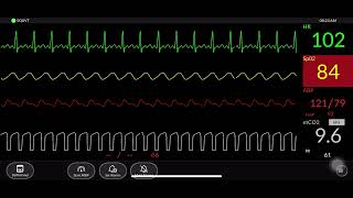 Simulated Patient Monitor [upl. by Irv]