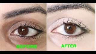 How to FADE DARK CIRCLES Dr Dray [upl. by Kurland]