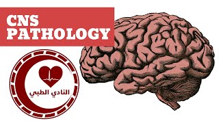 CNS Pathology  Edema Hydrocephalus amp Herniation [upl. by Enelaj]