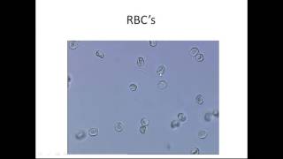 Microscopic Urinalysis [upl. by Weeks]