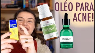 ÓLEO DE MELALEUCA  Para que serve Onde usar Como usar acneadulta acne [upl. by Deach]