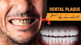 BEST REMEDY FOR DENTAL PLAQUE  Danto Ki Safai Ka Tarika  Natural Treatment For Dental Tartar [upl. by Violet]