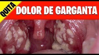 QUITA EL DOLOR DE GARGANTA sin medicamentos [upl. by Goltz]