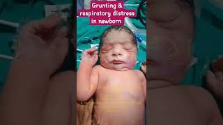 Respiratory distress amp grunting in newborn baby newborn viralvideo babyshorts love nicu cute [upl. by Jordison]