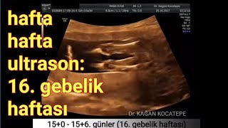 16 gebelik haftasında anne karnındaki kız bebek  açıklamalı ultrason görüntüleri [upl. by Gone]