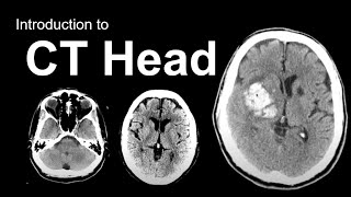 Introduction to CT Head Approach and Principles [upl. by Nodnarb]