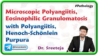 3 Microscopic Polyangiitis Eosinophilic Granulomatosis with Polyangiitis HenochSchönlein Purpura [upl. by Lishe]