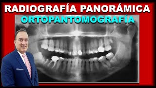 RADIOGRAFIAS PANORAMICAS DENTALES INTERPRETACION EN ORTODONCIA [upl. by Raseta]