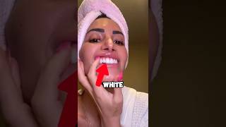 How To Whiten Your Teeth At Home 😧 [upl. by Monteith]