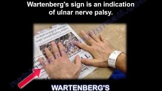 Wartenbergs Sign  Everything You Need To Know  Dr Nabil Ebraheim [upl. by Akiehs441]