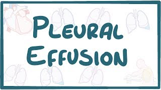 Pleural Effusion  causes symptoms diagnosis treatment pathology [upl. by Ellehcam]