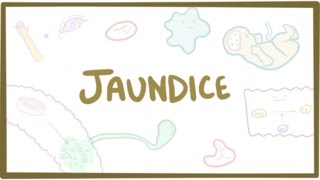 Jaundice  causes treatment amp pathology [upl. by Rubliw409]