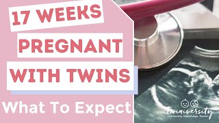 17 weeks pregnant twins to do list and what to expect [upl. by Eartha]