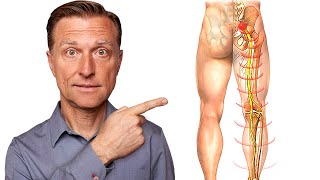 Say Goodbye to Sciatica Nerve Pain in 5 Minutes [upl. by Wennerholn]