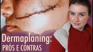 Raspar o rosto com lâmina  Dermaplaning  Opinião de Esteticista dermaplaning precodabeleza [upl. by Douville403]