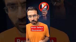 Big Brain Defect Affecting our Lives [upl. by Adnawt]