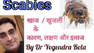 SCABIES COMPLETE CURE and treatment by DR YOGENDRA BOLA in hindiरात को होने वाली खुजली का इलाज [upl. by Aihsened]