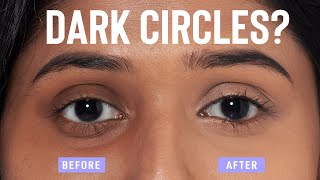 Natural home remedies for removing dark circles  Make your eyes look beautiful [upl. by Aiuqal]