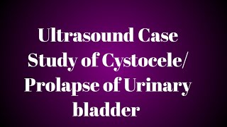 Ultrasound Case Study of CystoceleProlapse of Urinary bladder [upl. by Grochow]