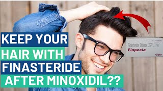 Can Finasteride Monotherapy Maintain Minoxidil Gains [upl. by Shanks625]