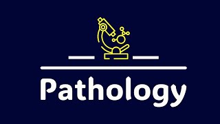 L2 Patho  Neoplastic LN [upl. by Fanning]