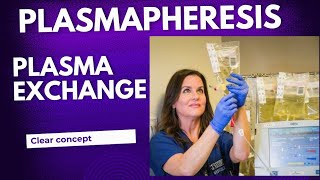 What is Plasmapheresis  How Plasmapheresis works [upl. by Nonie]