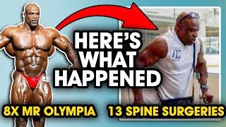 Ronnie Coleman Mr 8x Olympia to 13 Spine Sugeries Heres what happened [upl. by Edelstein]