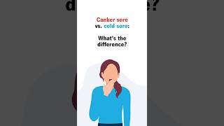 Canker sore vs cold sore Whats the difference [upl. by Kurland]