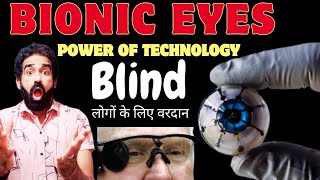 BIONIC EYES Blind  अंधे लोगों के लिए वरदानPower of Technology [upl. by Hattie]