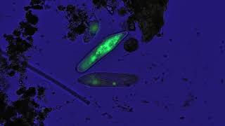 Freshwater ciliates stained acridine orange [upl. by Rehposirhc]